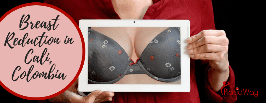 Breast Reduction in Cali, Colombia